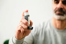 Melasma Tedavisi Yazın Sürdürülmeli Mi?